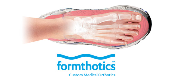 Formthotics custom hot sale medical orthotics